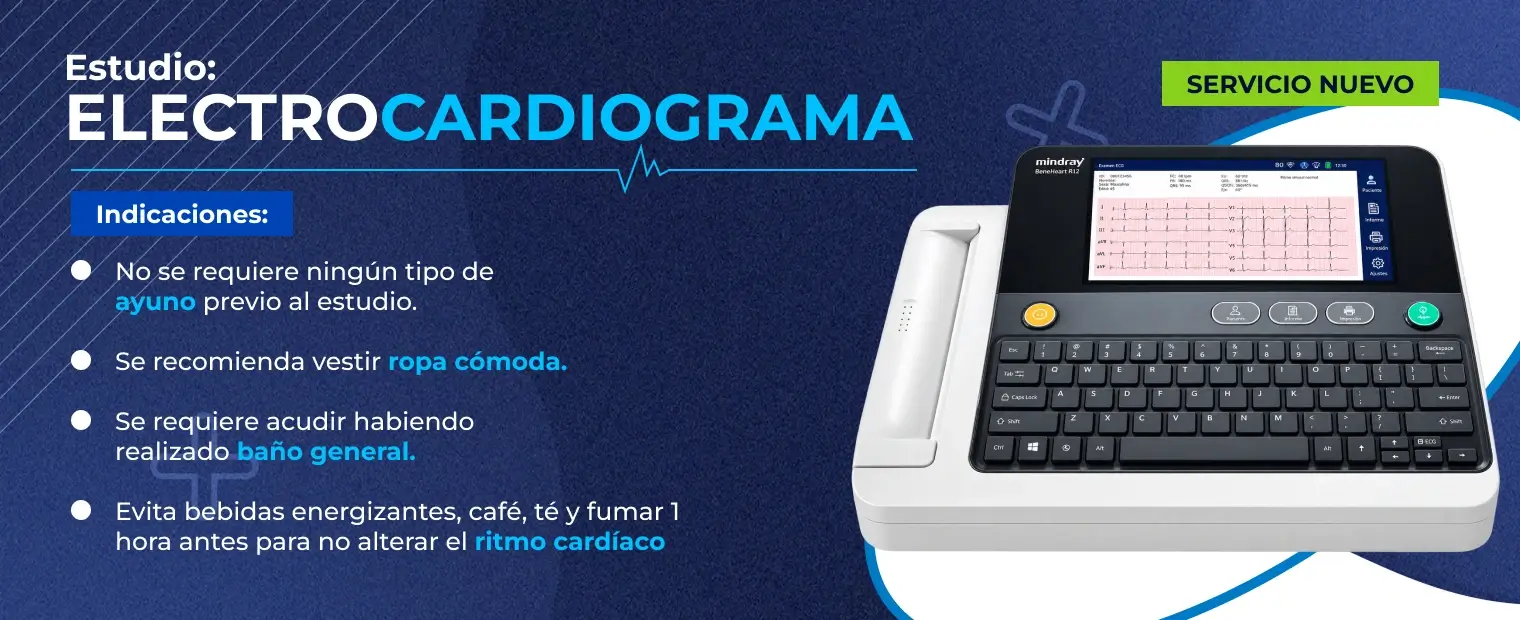 Electrocardiograma